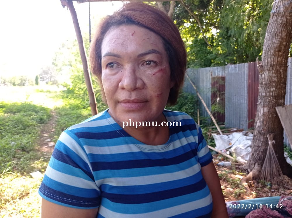 Perayaan Ultah Pernikahan Berujung Kekerasan Bersama  Wiwi : Saya Sudah Melaporkan Mereka Ke Polres 